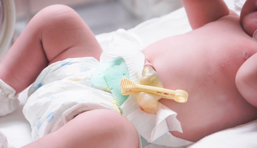 A baby is laying in a hospital bed.