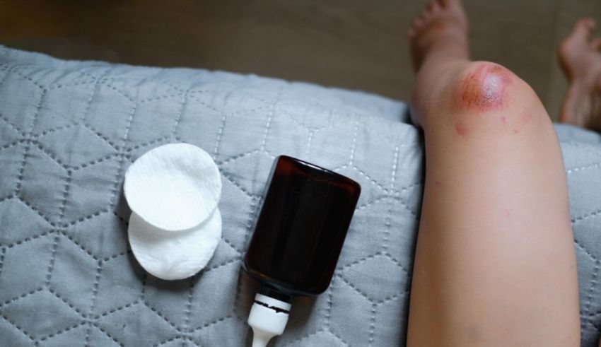 A woman is sitting on a bed with a bottle of lotion on her leg.
