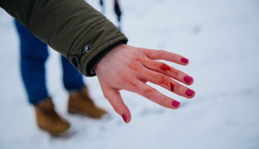 A woman's hand with blood on it in the snow.